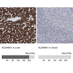 ALDH6A1 Antibody, Novus Biologicals:Antibodies:Primary Antibodies